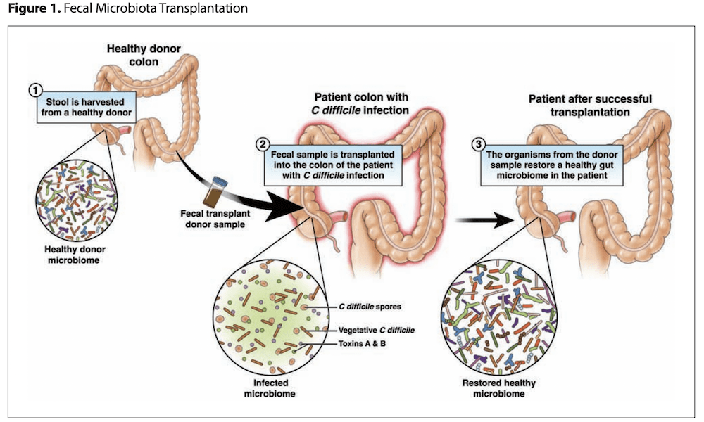 trust-your-gut:-the-profound-implications-of-the-microbiome-for-our-health