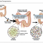 trust-your-gut:-the-profound-implications-of-the-microbiome-for-our-health